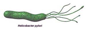 Helicobacter Pylori1